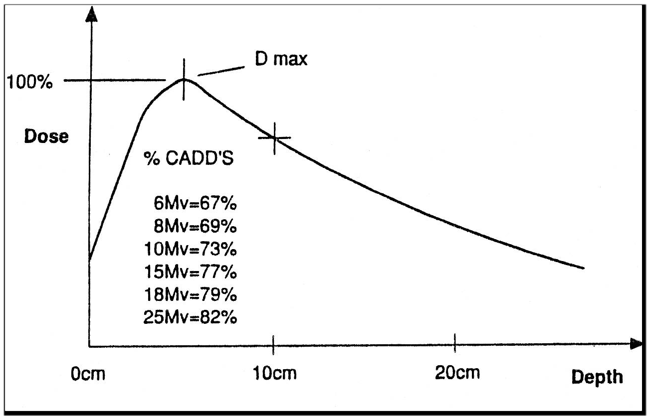 Reference: Image Courtesy of Elekta